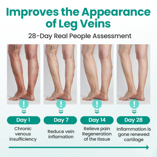 LAOZIK® LegRenew Varicose Veins Patch - Image 4