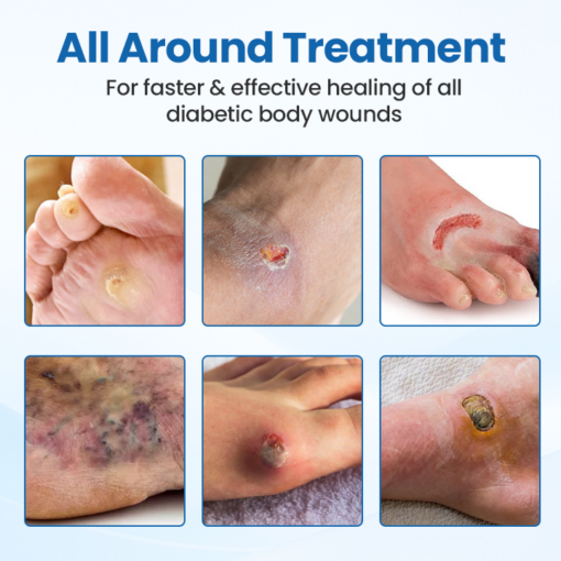 LAOZIK™ GlycoZen Skin Recovery Band - Image 4